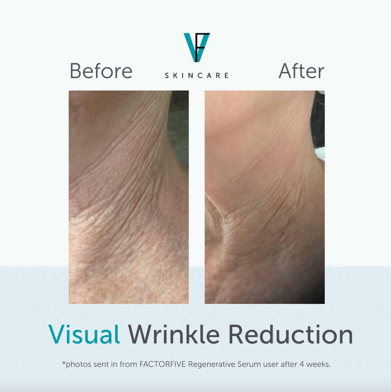 Factor Five Regenerative Serum