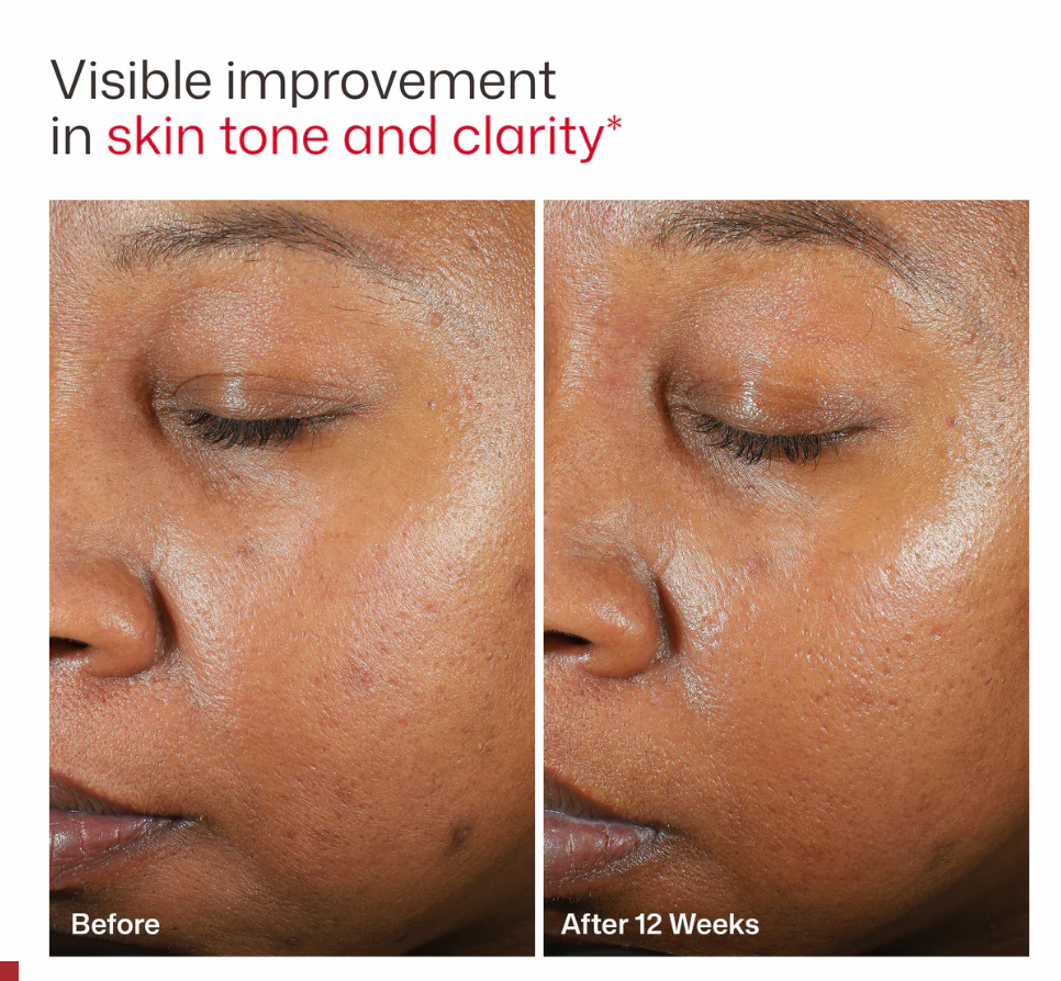 EltaMD UV Clear Tinted Broad-Spectrum SPF 46